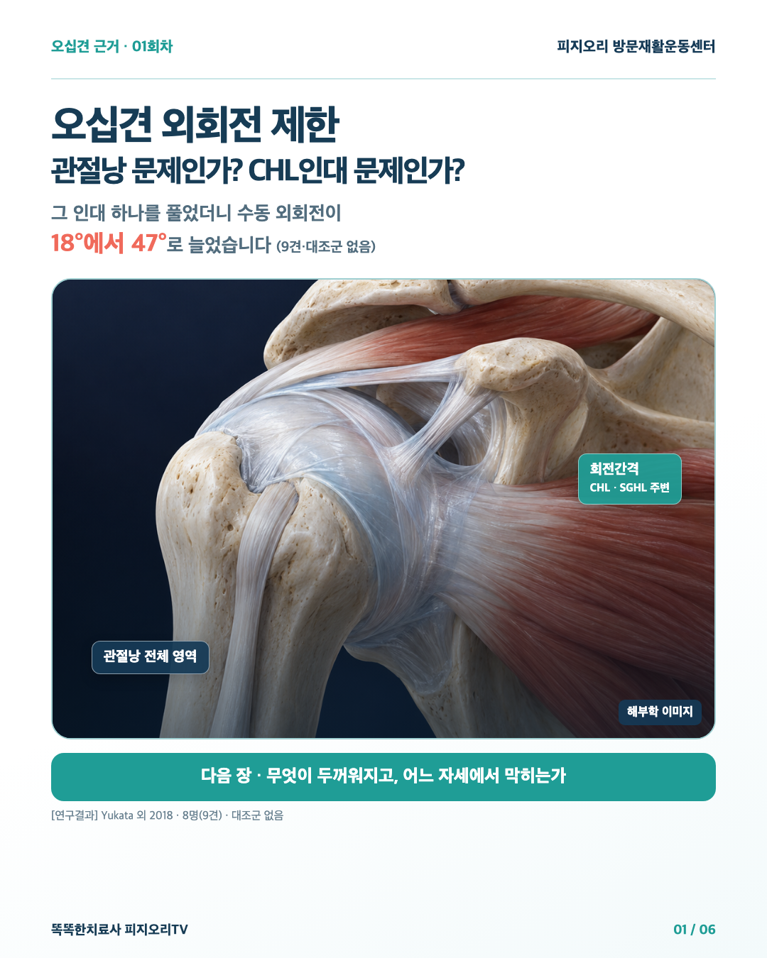 오십견인데 바깥으로 돌리기만 유독 안 된다면 — 관절낭 전체일까, CHL인대 한 곳일까