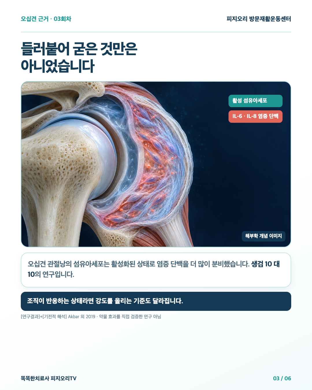 관절낭 단면과 활성 섬유아세포·IL-6·IL-8 개념 이미지
