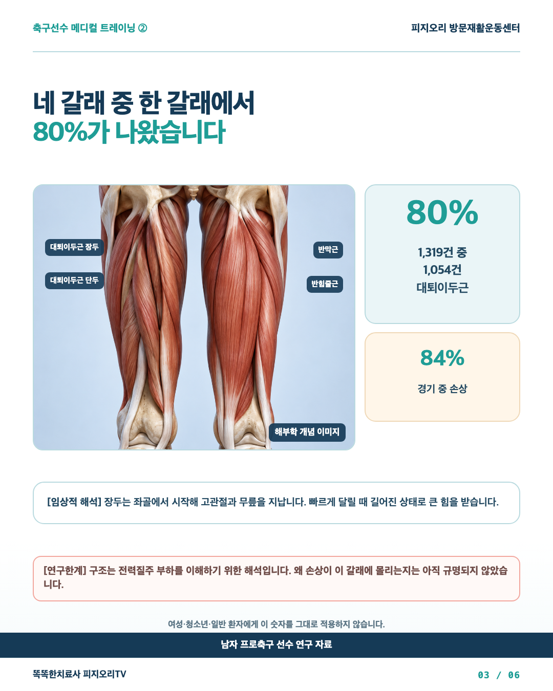 대퇴이두근 장두와 햄스트링 손상 분포 해부학 이미지
