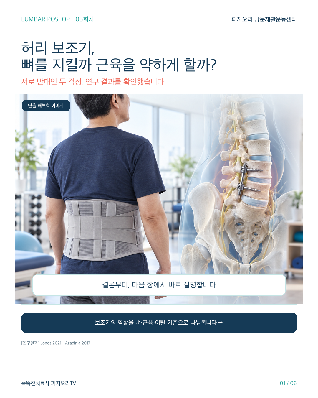 척추유합술 후 허리보조기, 언제 벗어야 할까? 뼈 고정과 근육 약화에 대한 근거