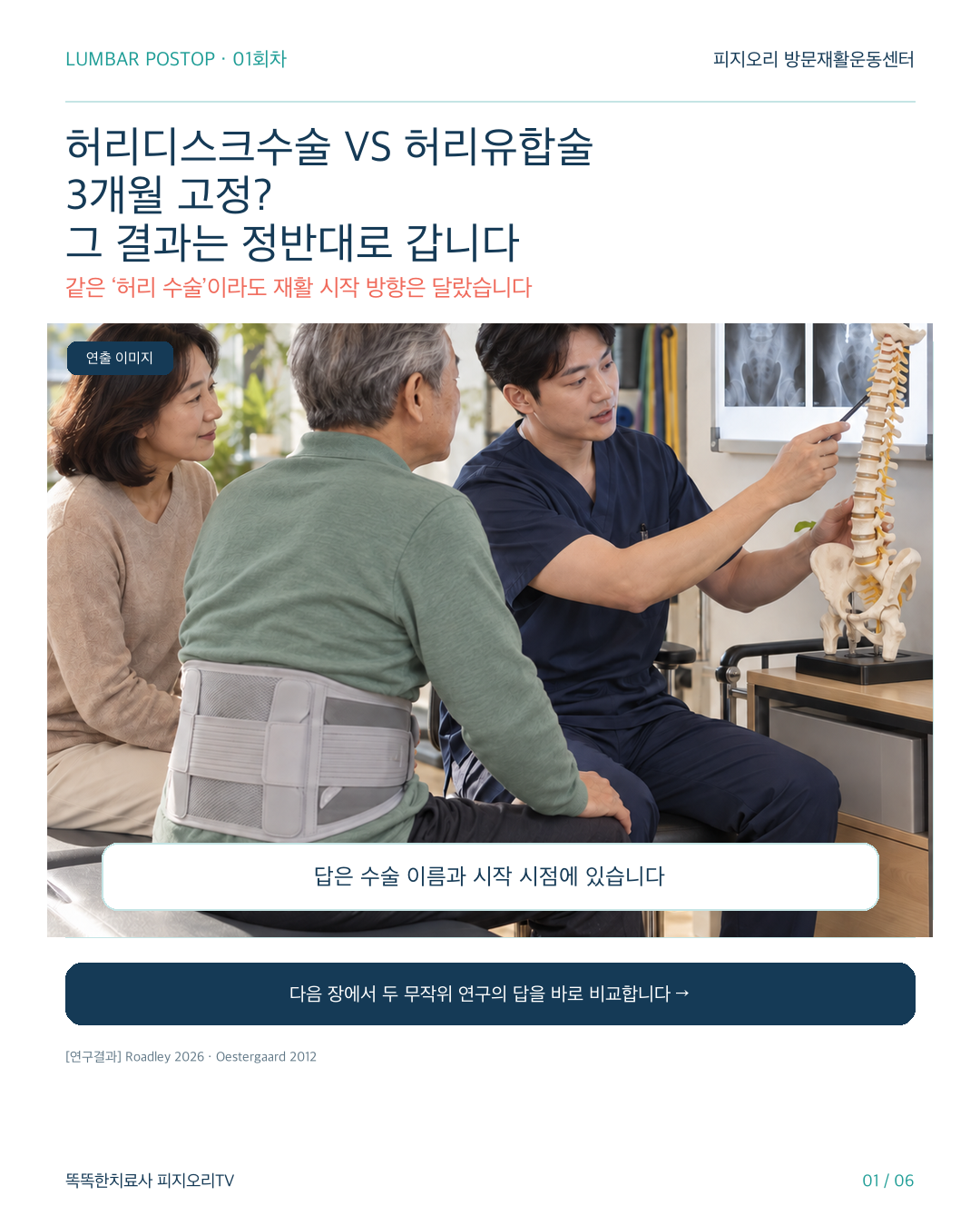 허리디스크수술 후 재활, 3개월을 무조건 기다려야 할까? 유합술과 다른 이유