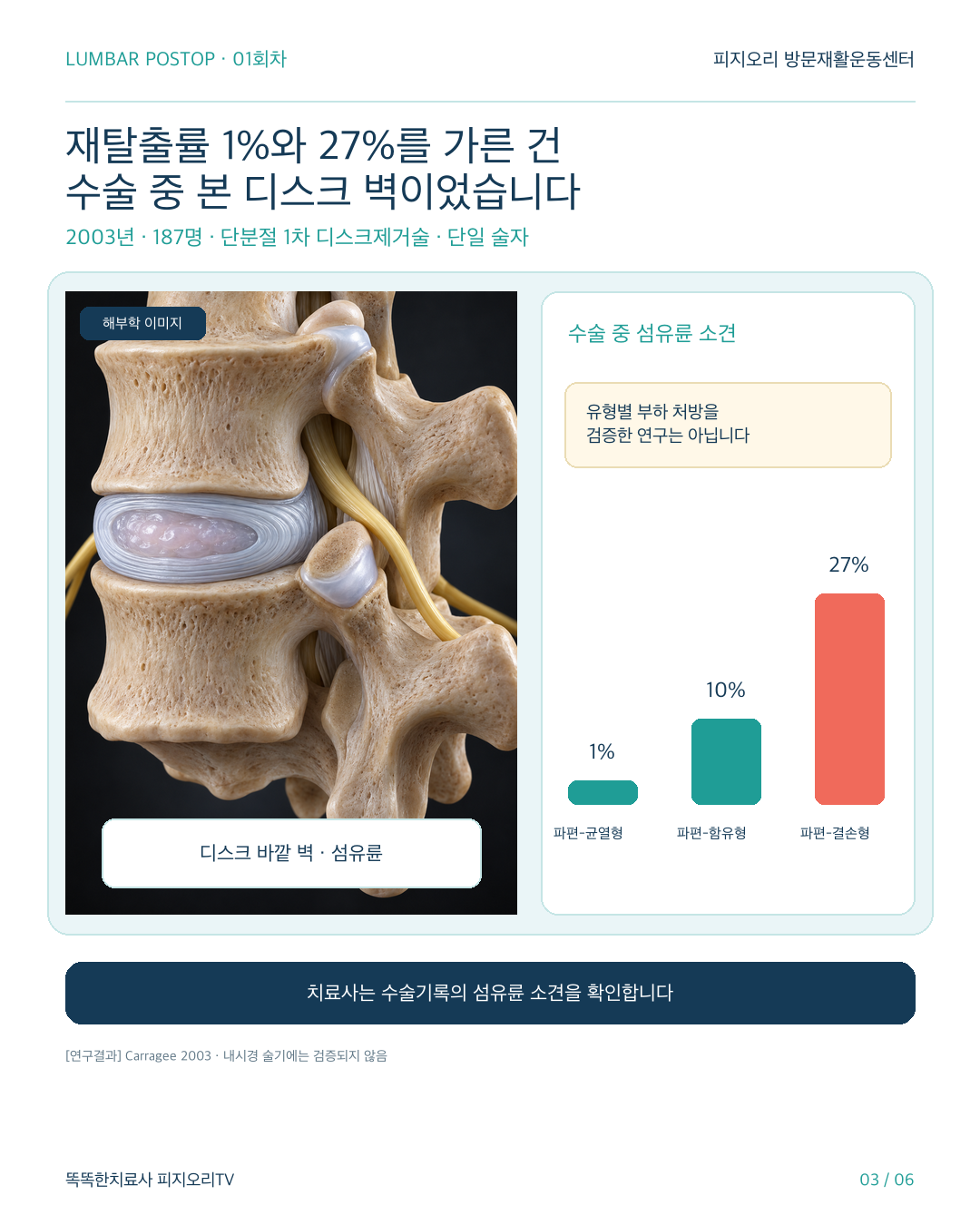허리수술 후 재활 카드뉴스 3번 이미지