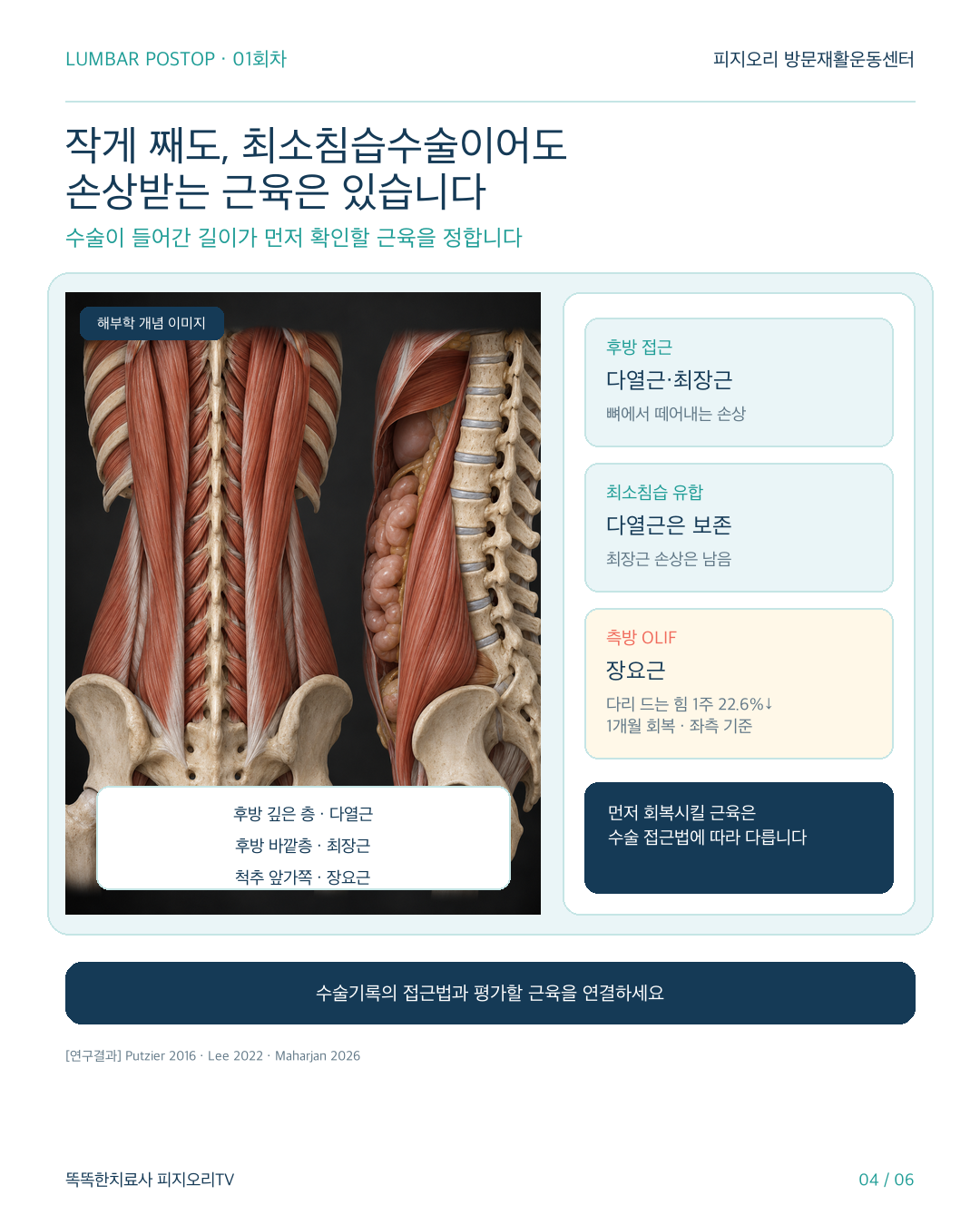 허리수술 후 재활 카드뉴스 4번 이미지